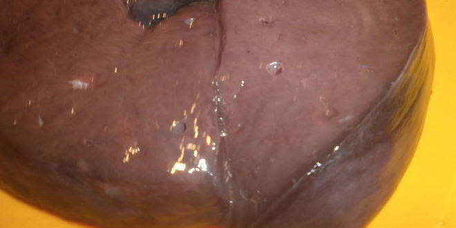 Рецепт говяжьей печени с яблоками и луком по-берлински