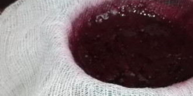 Рецепт вина из шелковицы